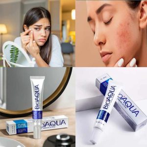 BioAqua Skin Acne Removal Cream (30 gram)